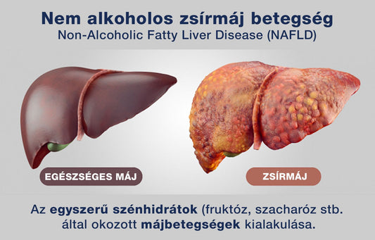 Nem alkoholos zsírmáj betegség - Hammer Nutrition CEE